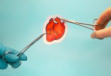 Фото - Контроль рисков: ученые научились прогнозировать развитие осложнений на сердце